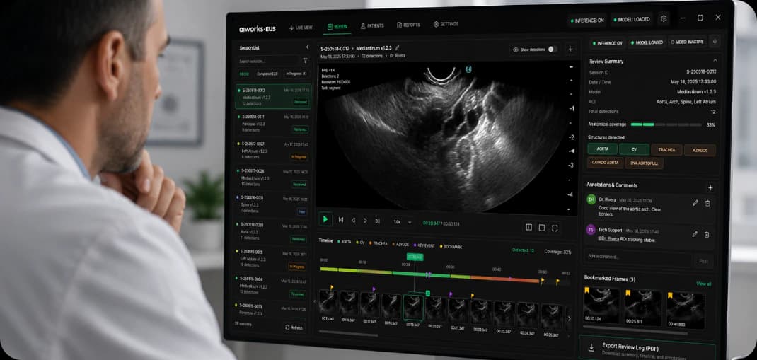 Professional reviewing endoscopic ultrasound detections and history in aiworks E.U.S.